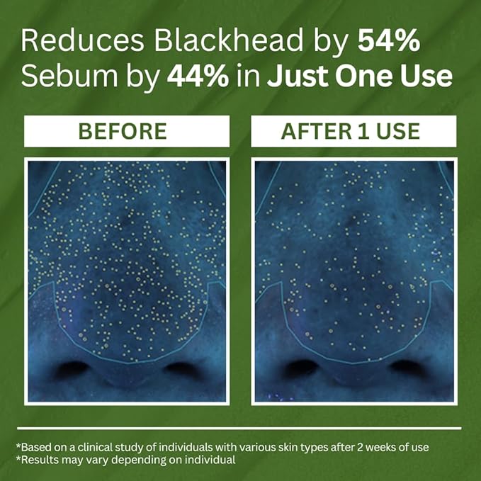 Masque profond à bulles au basilic sacré